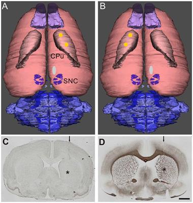 Botulinum Neurotoxin A Injected Ipsilaterally or Contralaterally into the Striatum in the Rat 6-OHDA Model of Unilateral Parkinson’s Disease Differently Affects Behavior